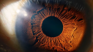 Life After Macular Hole Surgery: Recovery, Vision Improvement, and What Else You Need to Know