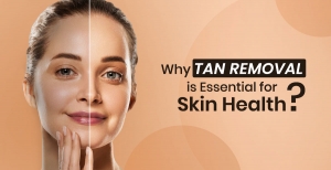 Why Tan Removal is Essential for Skin Health