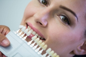 How Long Do Veneers Last? Tips to Extend Their Life