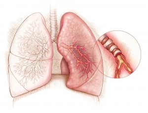 When Is the Best Time to Seek Asthma Treatment?