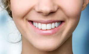 How Does Teeth Whitening in Silicon Oasis Work?