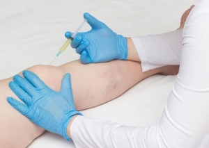 Knee Pain Doctor: Find the Best Treatment for Your Knee Discomfort