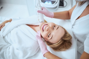 Can fractional RF microneedling improve the appearance of fine lines around the mouth?