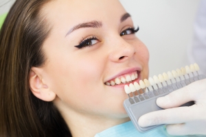 Smile Trends: Why Veneers Are Here to Stay