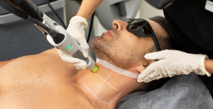 10 Ideas for Enhancing Laser Hair Removal Results