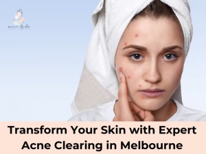 Transform Your Skin with Expert Acne Clearing in Melbourne