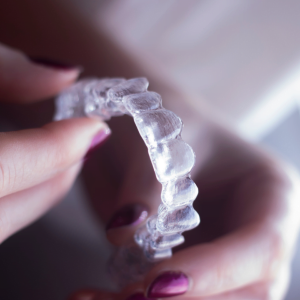 Retainers for Life? Breaking Down the Myths and Realities