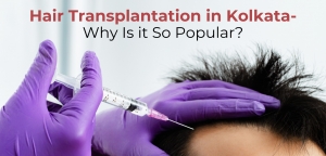 Hair Transplantation in Kolkata - Why Is it So Popular?