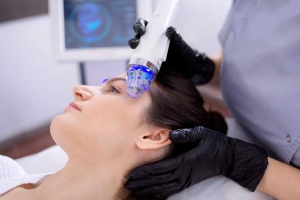 The Power of Fractional RF Microneedling for Youthful Skin in Dubai