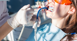 Erase Years of Stains with Zoom Teeth Whitening