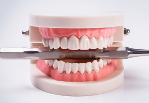 Achieve Your Ideal Smile with Full Mouth Rehabilitation in Dubai