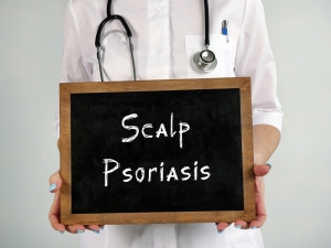 What is Scalp Psoriasis and how is Ayurvedic treatment useful for it?