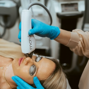 Why Should You Consider Laser Treatments?