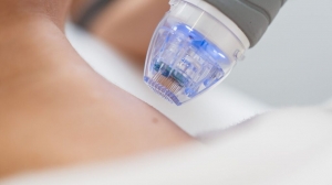 Fractional RF Microneedling for Non-Invasive Face Lifting in Dubai