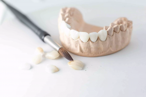 Are Dental Veneers Safe? What You Should Know Before Getting Them