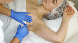 Botox for Armpit Sweating Dubai’s Solutions to Hyperhidrosis