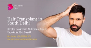 What Is The Right Age for Hair Transplant?