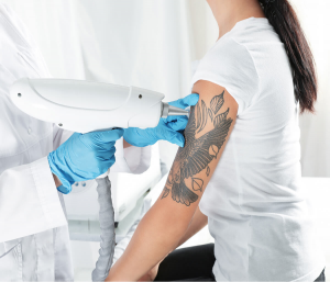 The Truth About Laser Tattoo Removal in Dubai: What You Need to Know