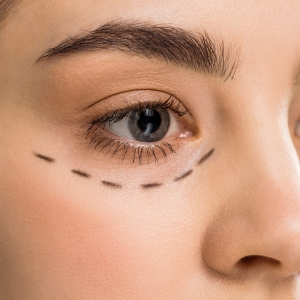 Your Guide to Eyelid Surgery Rejuvenation