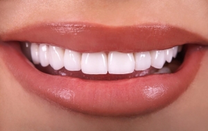 What Do You Know About Deep Teeth Cleaning?
