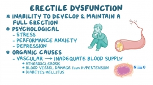 Erectile Dysfunction Market Size, Analysis, Industry Statistics and Latest Insights Till 2034