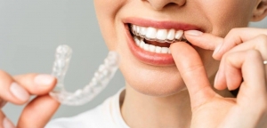 Aligners and Self-Care: How to Keep Your Smile Beautiful