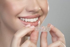 The Invisible Way to Straighten Your Teeth: A Guide to Aligners
