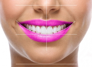 How can you check whether you need a Smile Design?