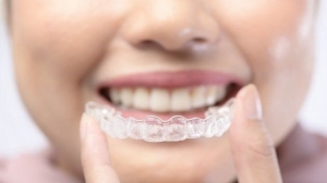 Clear Aligners: A Modern Alternative to Traditional Braces