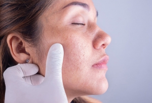 How do dermatologists in Dubai help with skin conditions caused by lifestyle choices?
