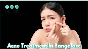 What Is The Main Cause Of Acne On The Face?