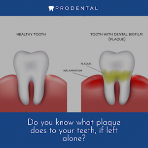 10 Reasons to Choose Invisalign for a Perfect Smile