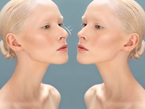 Why Should You Consider Rhinoplasty?