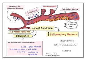 Behcet's Syndrome Market Size, Share, Trends, Industry Report 2024-34