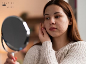 Gentle Solutions for Rosacea Repair and Relief