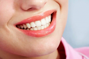 How to Care for Your Teeth After Root Canal Treatment
