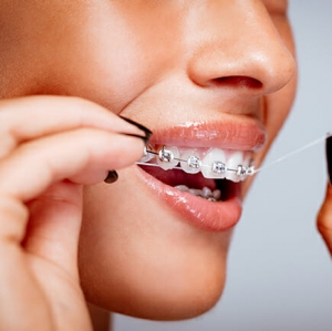 Clear and Traditional Braces Available in Dubai