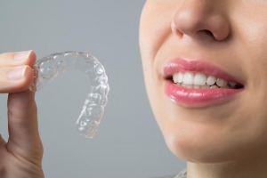 The Science of Aligners: How They Work to Transform Your Smile