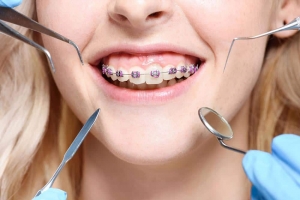 The Importance of Proper Dental Appliances for Children