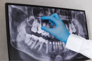 Affordable Panoramic X-Ray Services for Better Oral Health in Dubai