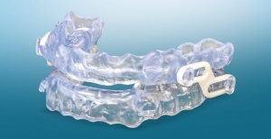 Clear Aligners vs. Braces: Which Appliance Is Right for You?