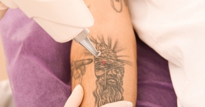 Get Rid of Tattoos for Good with Dubai’s Laser Experts