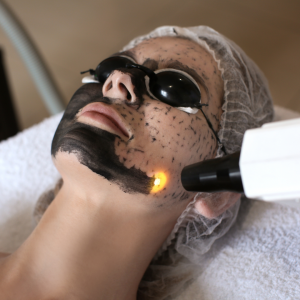 Safe and Effective Laser Carbon Peel 