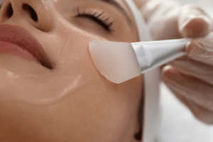 Chemical Peels in Dubai