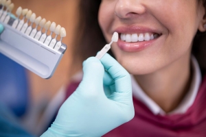 How Dental Veneers Can Fix Common Smile Imperfections