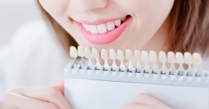 Are Dental Veneers Worth the Investment? Here’s What You Need to Know