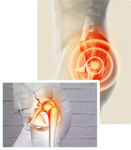 Get Reliable Hip Replacement in Lahore with Ortho Center Specialists