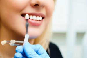 Achieve a Hollywood Smile with Custom Dental Veneers
