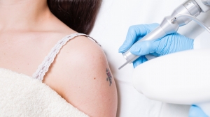 Experience the Fastest Results with Laser Tattoo Removal in Dubai