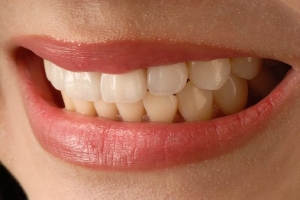 Fast, Safe, and Effective Nano Teeth Whitening